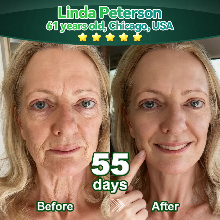 💖Change from the inside out | Purelora® Stem Cell–Derived EGF & Copper Peptide Activating Serum  (Deeply activates skin renewal from within for firmer, smoother-looking skin) - Image 9